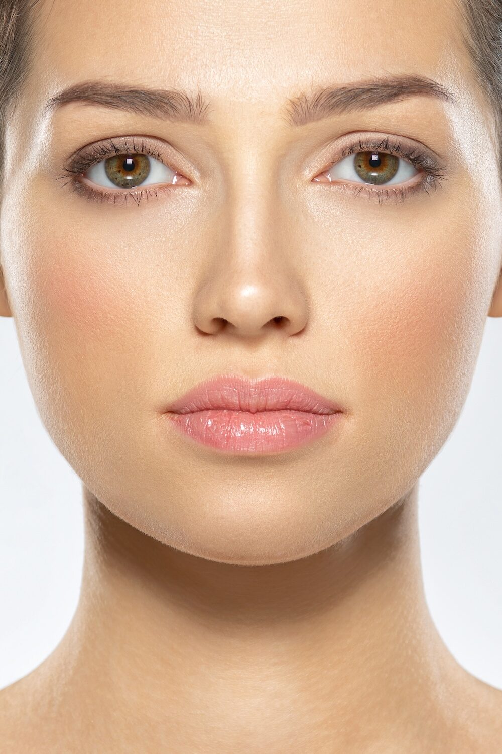 Facial implants patient result showing enhanced facial structure and definition